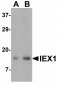 IL-17 Antibody