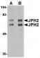 JPH2 Antibody
