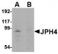 JPH4 Antibody
