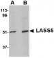 LASS5 Antibody