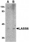 LASS6 Antibody