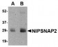 NIPSNAP2 Antibody