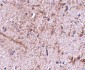 TOM70 Antibody