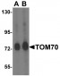 TOM70 Antibody