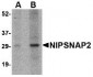 NIPSNAP2 Antibody