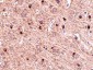 TOM70 Antibody