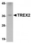 TREX2 Antibody
