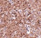 IL-16 Antibody