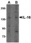 IL-16 Antibody