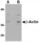 Beta-actin Antibody