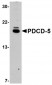 PDCD5 Antibody