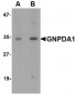 GNPDA1 Antibody