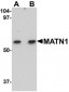 MATN1 Antibody