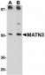 MATN3 Antibody