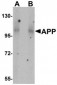 APP Antibody