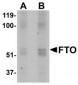 FTO Antibody