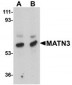 MATN3 Antibody