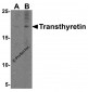Transthyretin Antibody