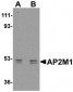 AP2M1 Antibody