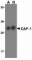 RSPO1 Antibody