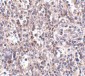 SCARB1 Antibody