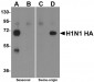 Seasonal H1N1 Hemagglutinin Antibody