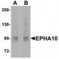 EphA10 Antibody