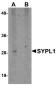 SYPL1 Antibody