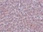 JMJD1B Antibody