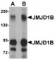 JMJD1B Antibody