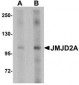 JMJD2A Antibody