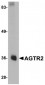 AGTR2 Antibody