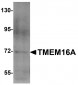 TMEM16A Antibody