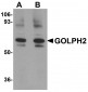 GOLPH2 Antibody