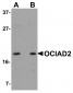 OCIAD2 Antibody
