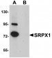 SRPX1 Antibody