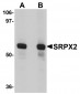 SRPX2 Antibody