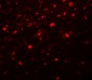 Girdin Antibody