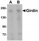 Girdin Antibody