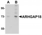 ARHGAP18 Antibody
