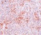 BFAR Antibody