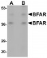 BFAR Antibody