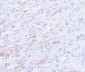 TCF3 Antibody