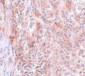 BCAS2 Antibody