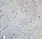 DCLK1 Antibody