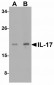 DCLK1 Antibody