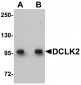 DCLK2 Antibody