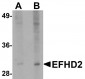 EFHD2 Antibody