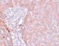 LYRM3 Antibody