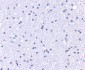 APC1 Antibody